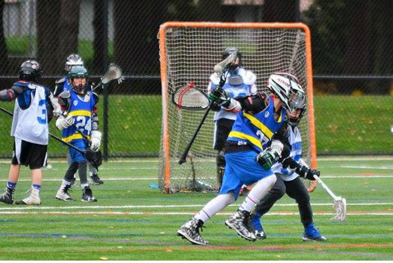 STX Exo Arm Guards - Image 2